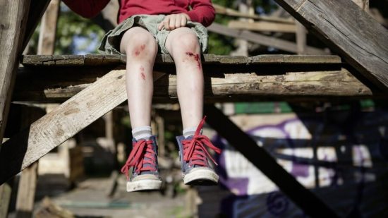 prevenir-el-tetanos-en-ninos-5-tips