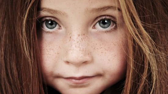 sintomas-detalles-sindrome-rett