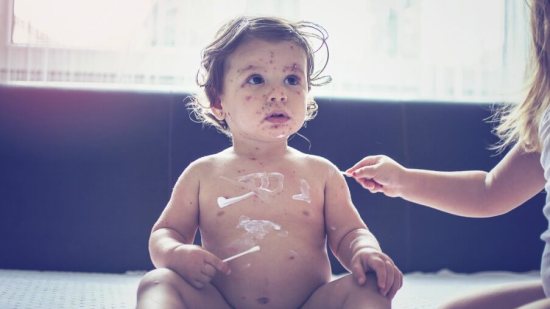 En-NY-niños-no-vacunados-contra-el-sarampión-no-pueden-ir-a-lugares-públicos