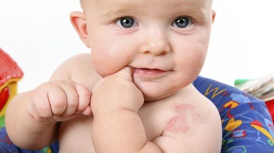 Tipos de marcas de nacimiento en bebés