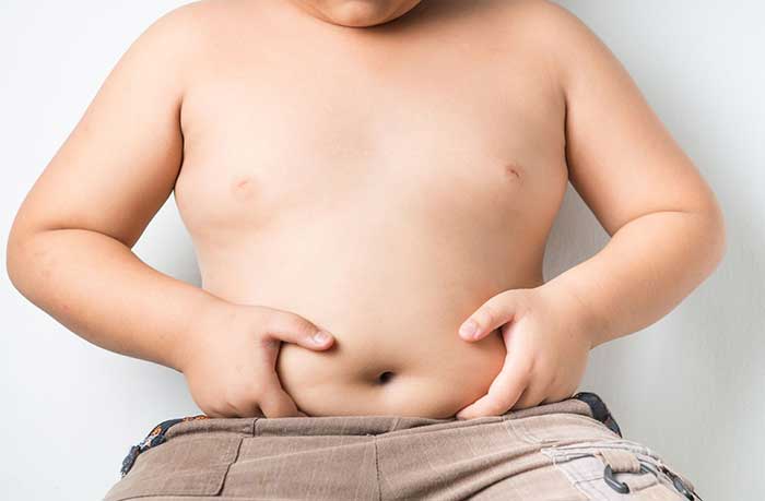 obesidad-peso-hijo-1