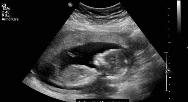 Conoce qué mensaje mandó este bebé a su mama