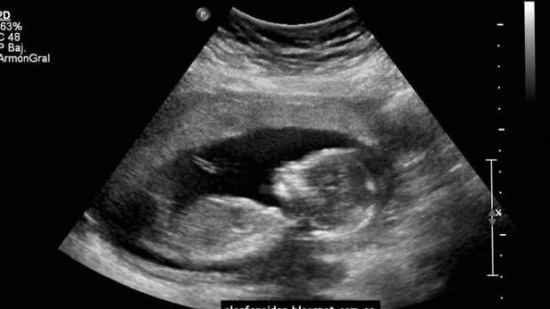 Conoce qué mensaje mandó este bebé a su mama