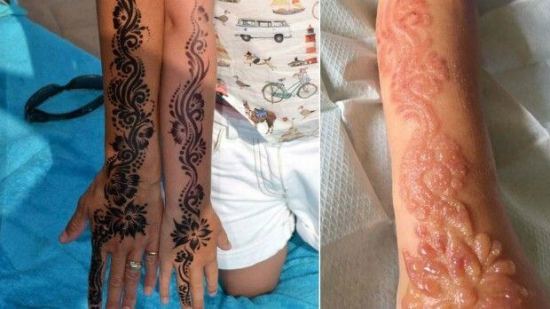 ¿Por qué no debemos hacerles tatuajes de henna a los niños?