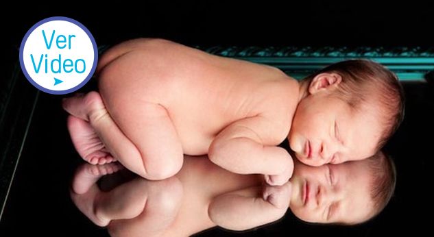 10 preguntas sobre la dermatitis atópica