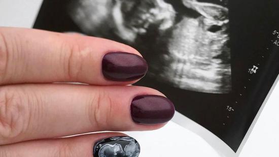 Uñas de ultrasonido